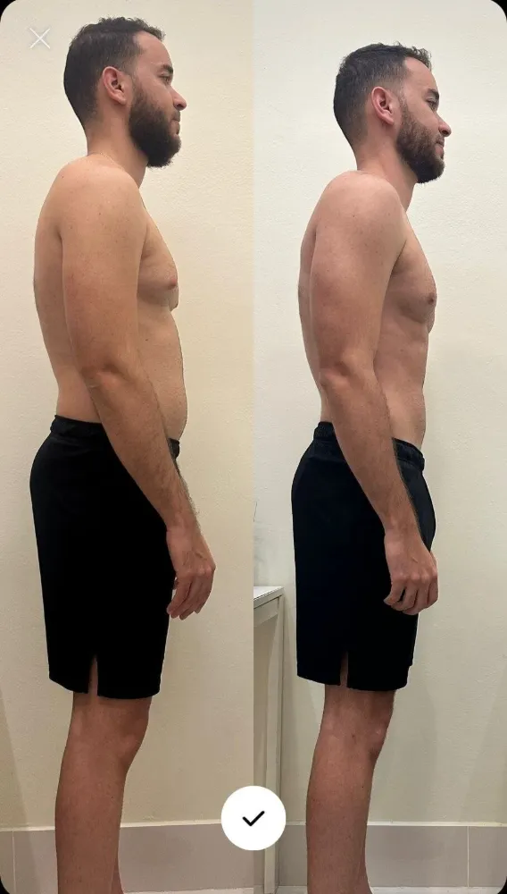 Transformación antes y después de cliente Origin Shape 9