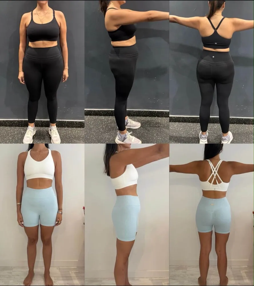 Transformación antes y después de cliente Origin Shape 38