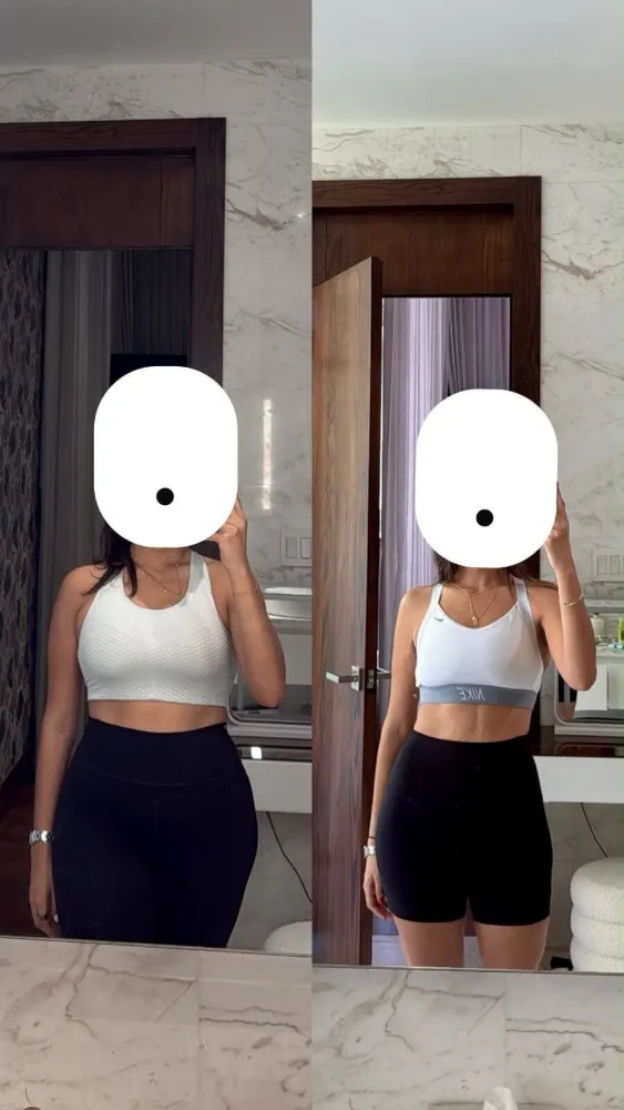 Transformación antes y después de cliente Origin Shape 39